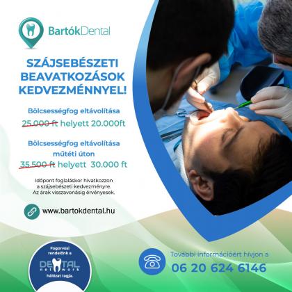 Szájsebészeti beavatkozás kedvezménnyel! Szájsebészeti beavatkozás kedvezménnyel!