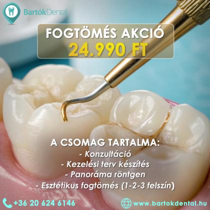 Fogtömés Akció