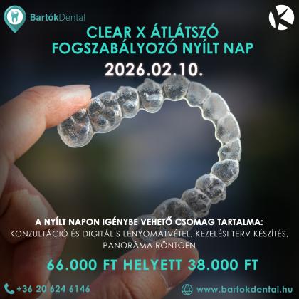 Clear X átlátszó fogszabályozó nyílt nap