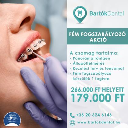 Fém Fogszabályozó Akció