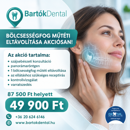 Bölcsességfog műtéti eltávolítása Bölcsességfog műtéti eltávolítása