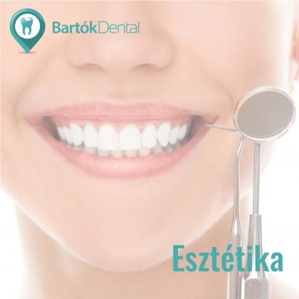 Cosmetic Dental Treatment!