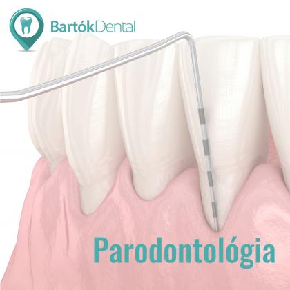 Parodontológia - az egészséges fogágyért